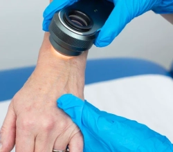 Skin Cancer Clinic