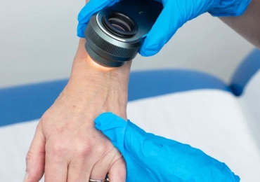 Skin Cancer Clinic