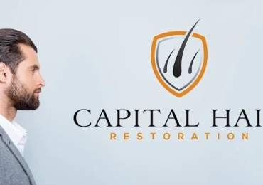 Capital Hair Restoration